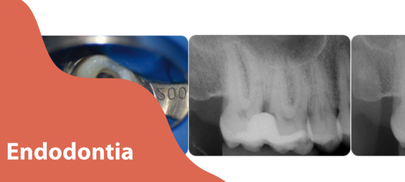 Endodontia